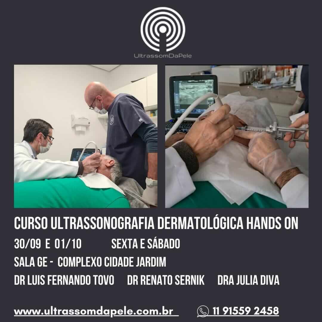 curso ultrassonografia dermatologica dr tovo e dr renato sernik