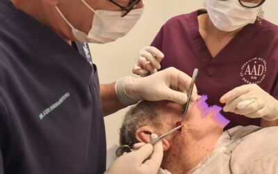 Câncer da Pele | Tratamentos cirúrgicos | dr Tovo Luis Fernando Tovo