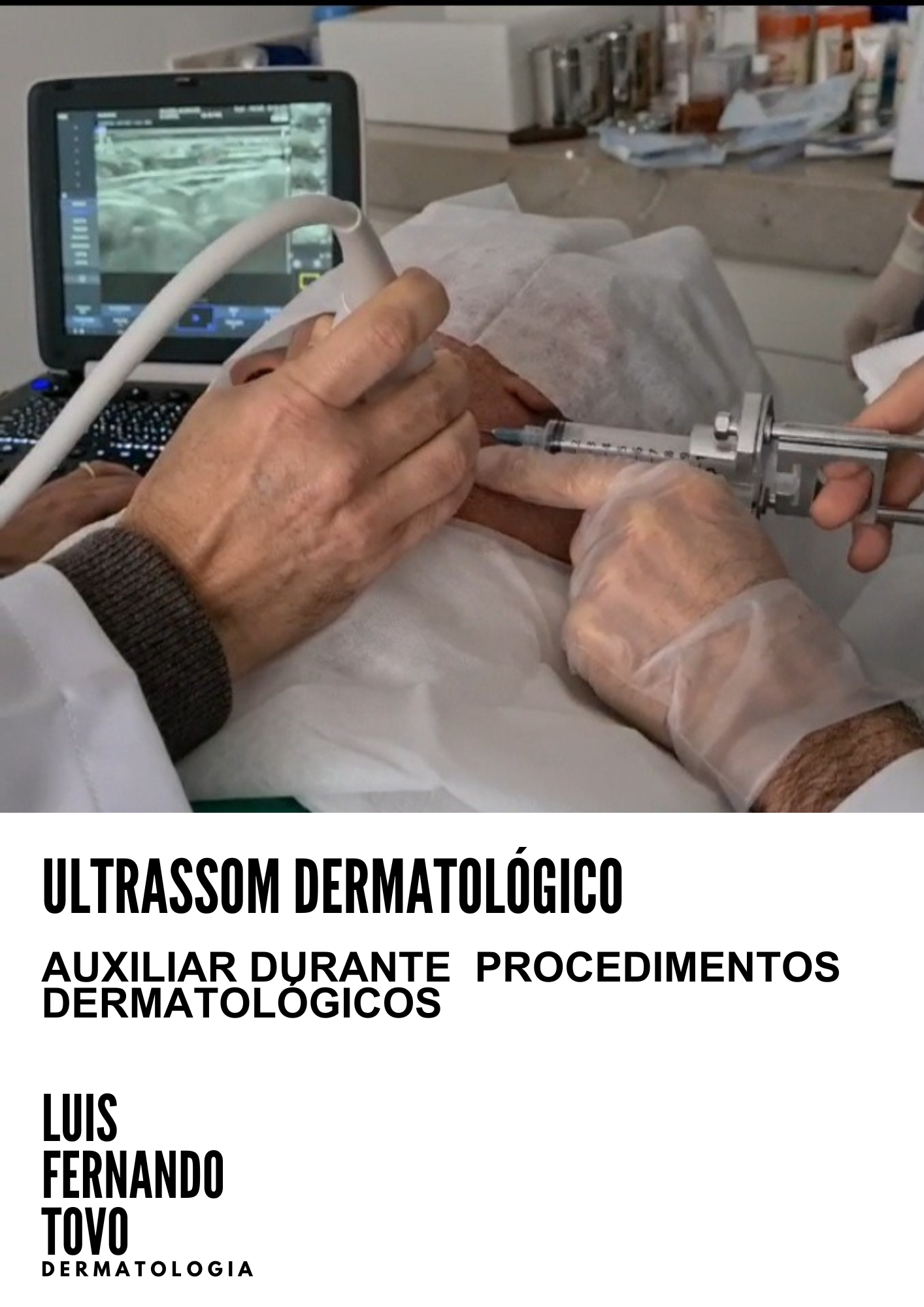 ultrassom dermatológico e seu uso na dermatologia dr tovo luis fernando tovo clinica tovo dermatologia