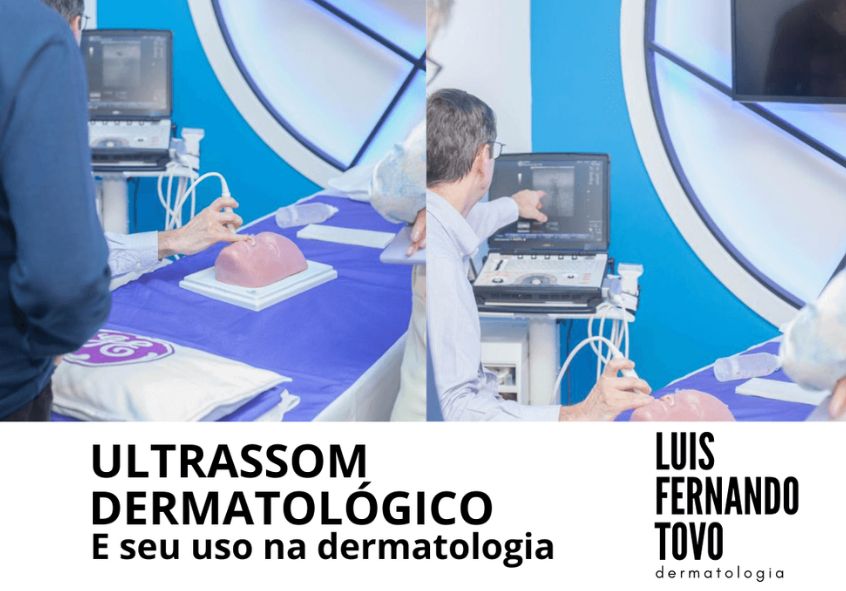 ultrassom dermatológico seu uso na dermatologia dr tovo luis fernando tovo clinica tovo dermatologia 3