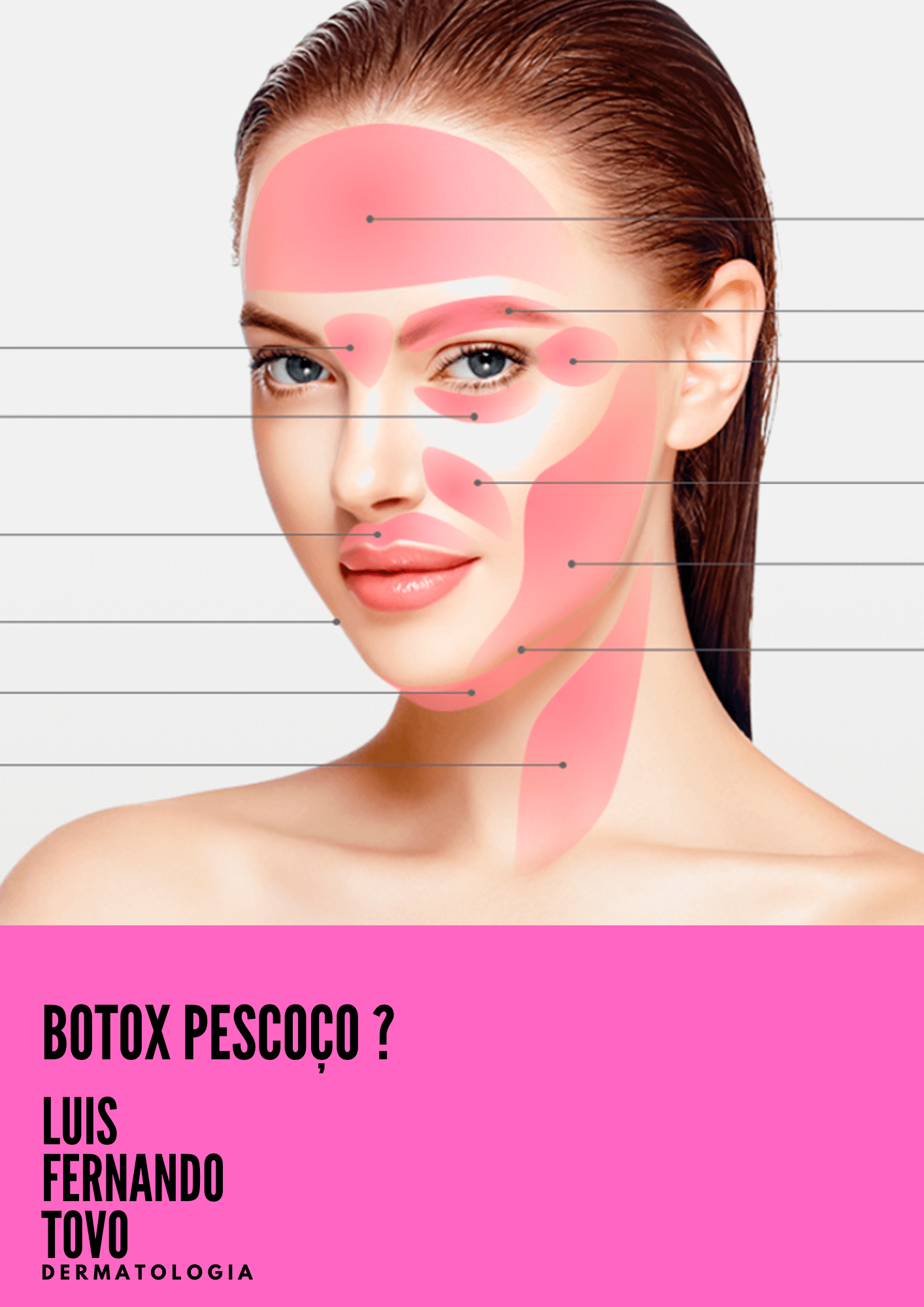 Barbie botox | toxina botunilica no pescoço para afinar? E seguro? dr tovo Luis Fernando