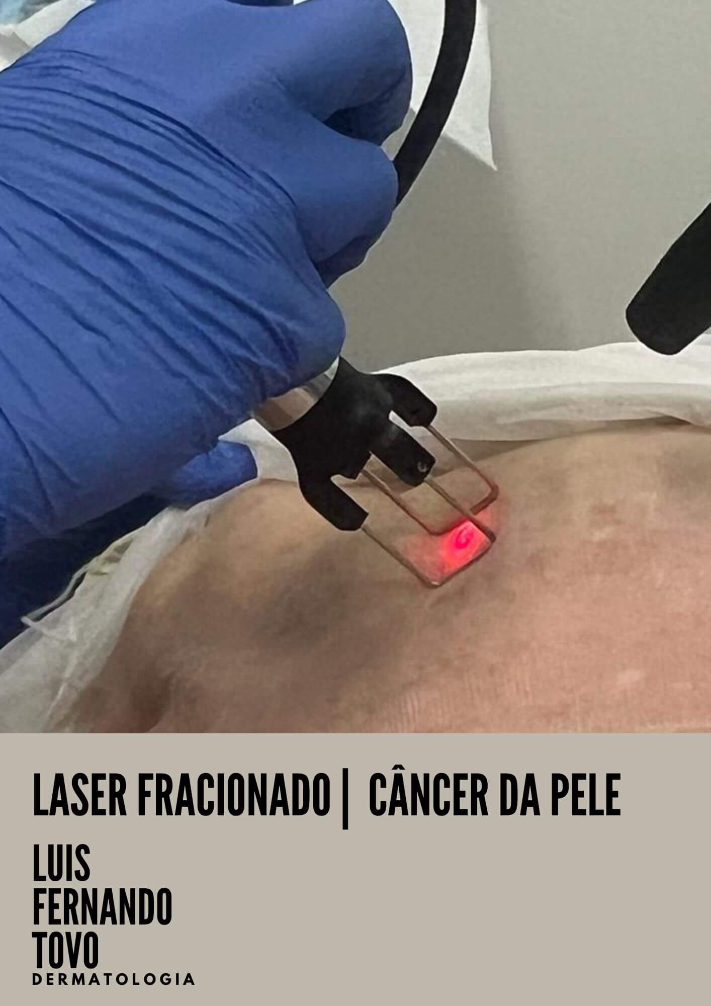 Especialista em Cancer da pele dr Tovo Luis Fernando Tovo