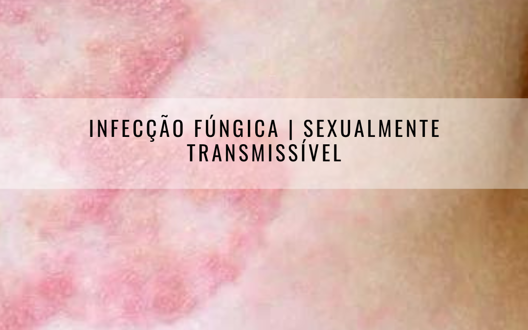 Infecção Fúngica sexualmente transmissível