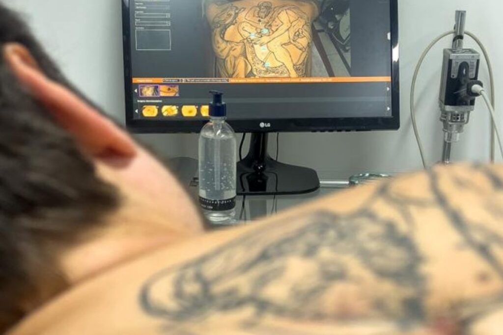 tatuagem e dermatologia dr tovo luis fernando tovo