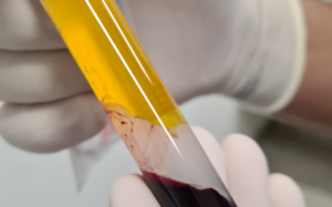 usodegorduracutâneanadermatologiadrtovo