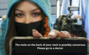 cancer de pele alerta clinica tovo