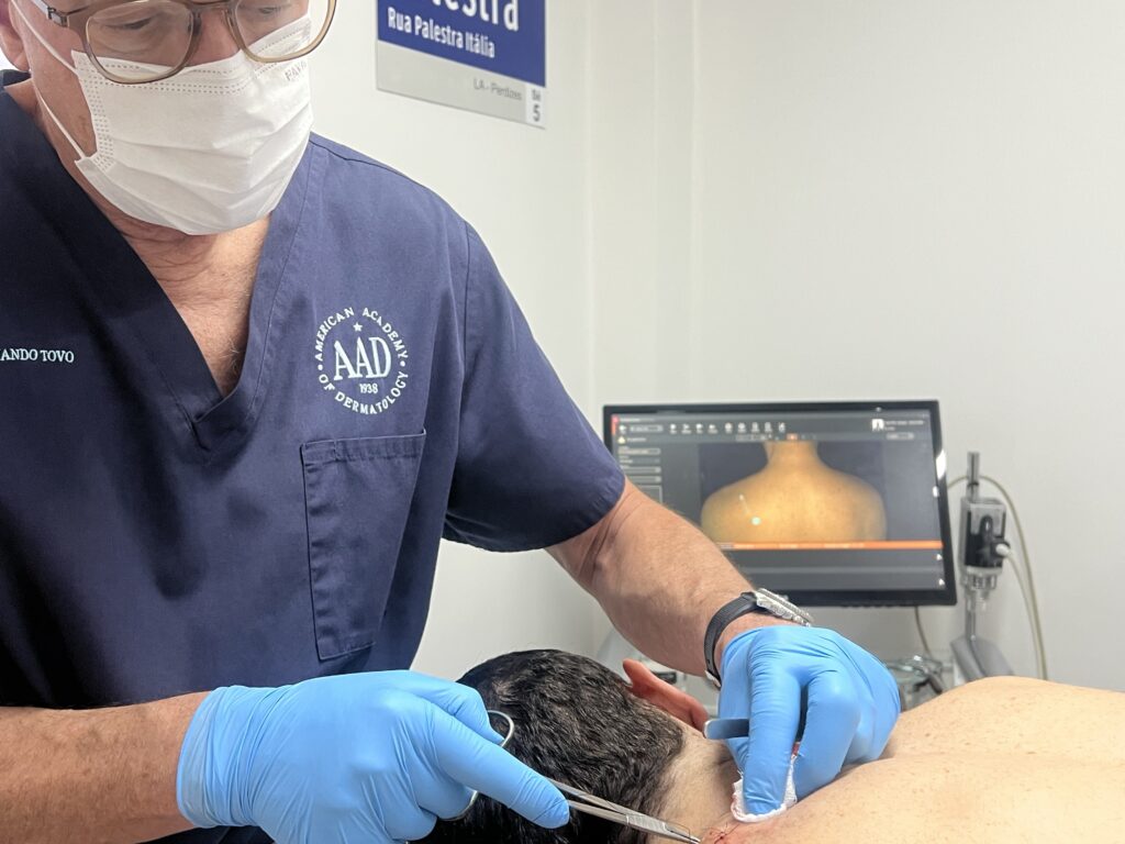 dermatologista no sirio libanes oncologia cutânea