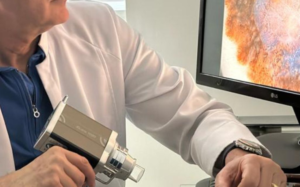 nucleo oncologia cutânea hospital sirio libanes dr tovo luis fernando