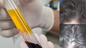 Clínica Tovo - Dr Tovo Telefone 3253 0319 - Luis Fernando Tovo Dermatologista