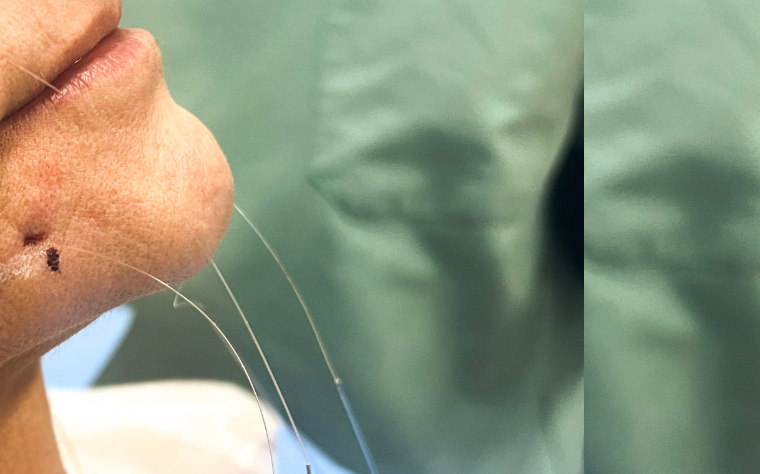 fiosdesustentaçãosilhouettedrtovo