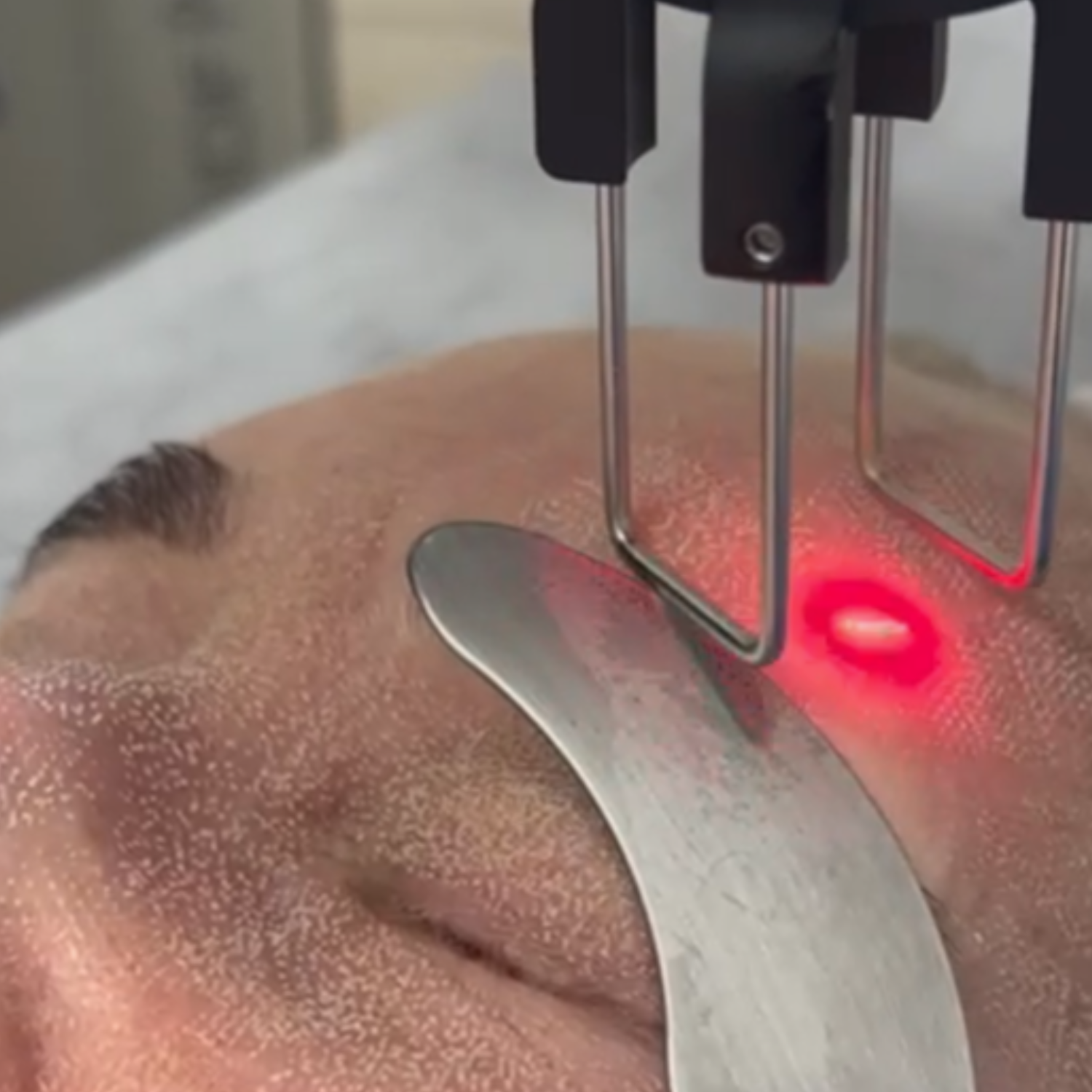 procedimentos a laser clinica tovo dr tovo telefone