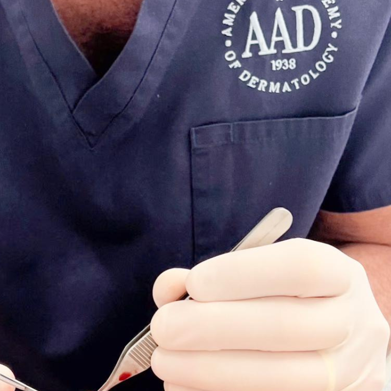 cirurgia de mohs dr tovo dermatologista especialista