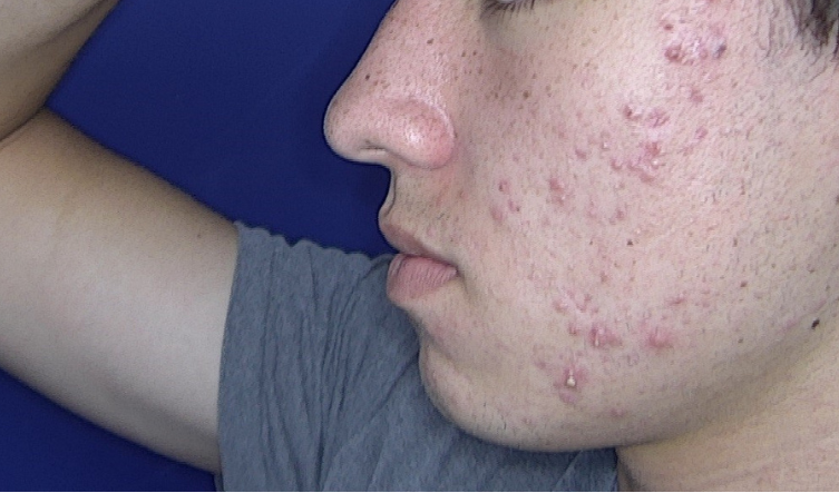 roacutanadolescentedrtovo