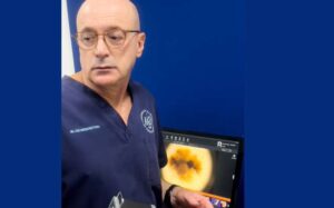 clinica-tovo-luis-fernando-tovo-dr-tovo-explica-o-que-e-a-dermatoscopia-digital/