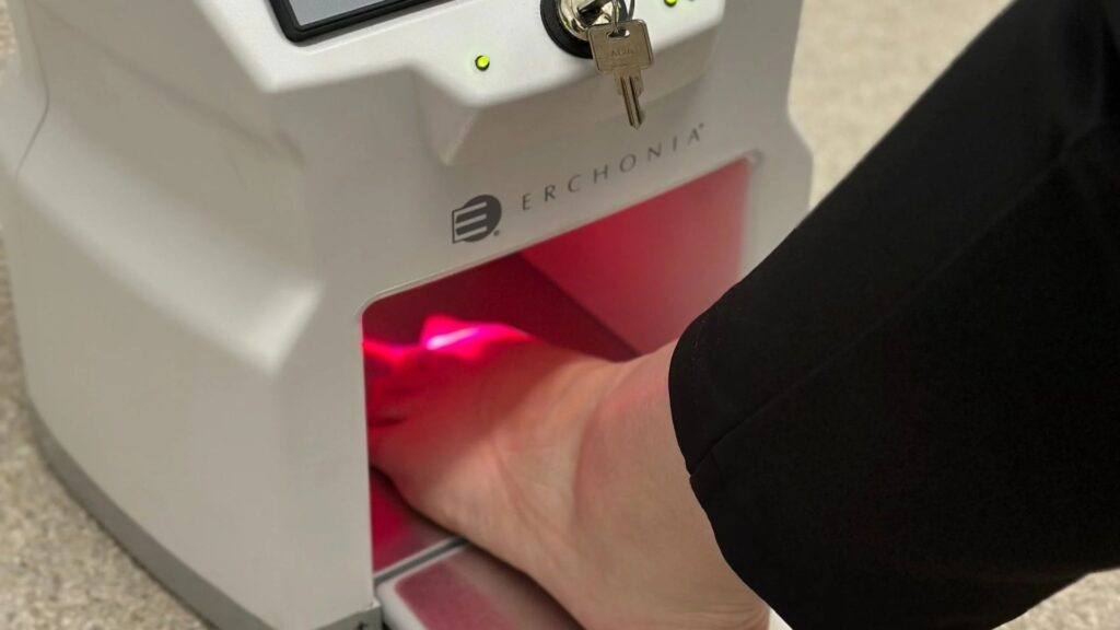 micose de unha lunula clinica tovo