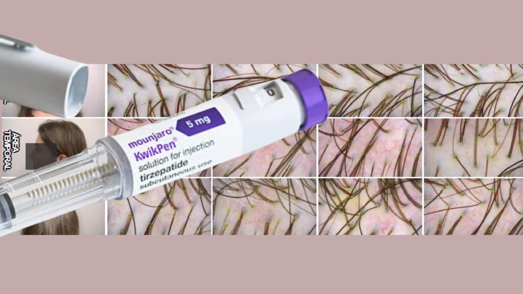 mounjaro e queda de cabelo dr tovo