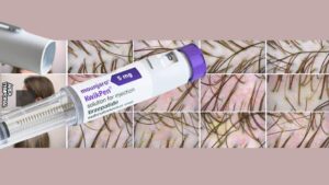 mounjaro e queda de cabelo dr tovo