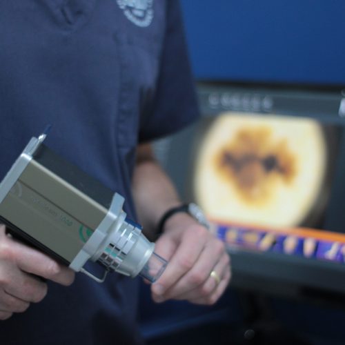 Dermatoscopia digital e mapeamento corpotal dr tovo