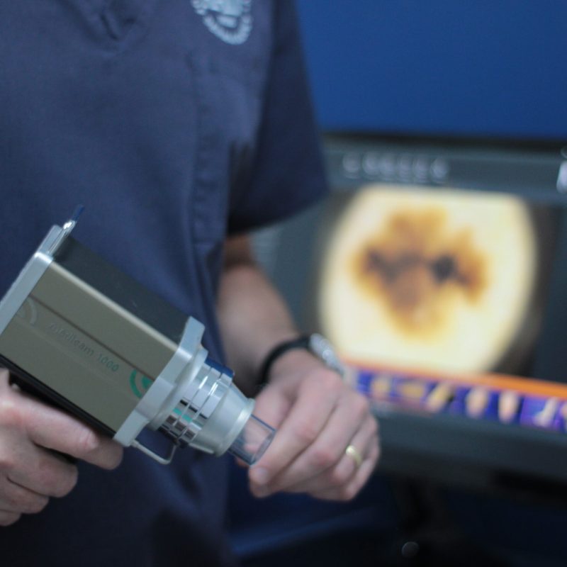 Dermatoscopia digital e mapeamento corpotal dr tovo