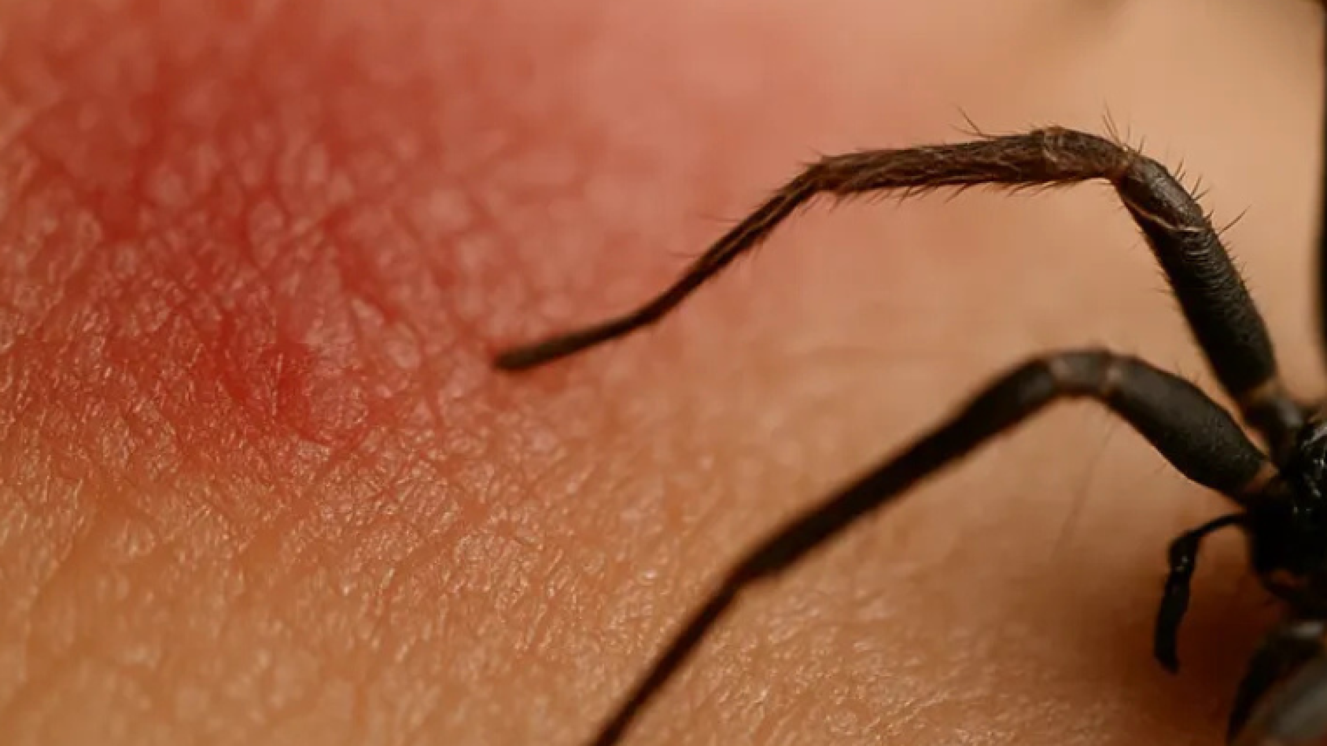 picadadearanhamarromdrtovo