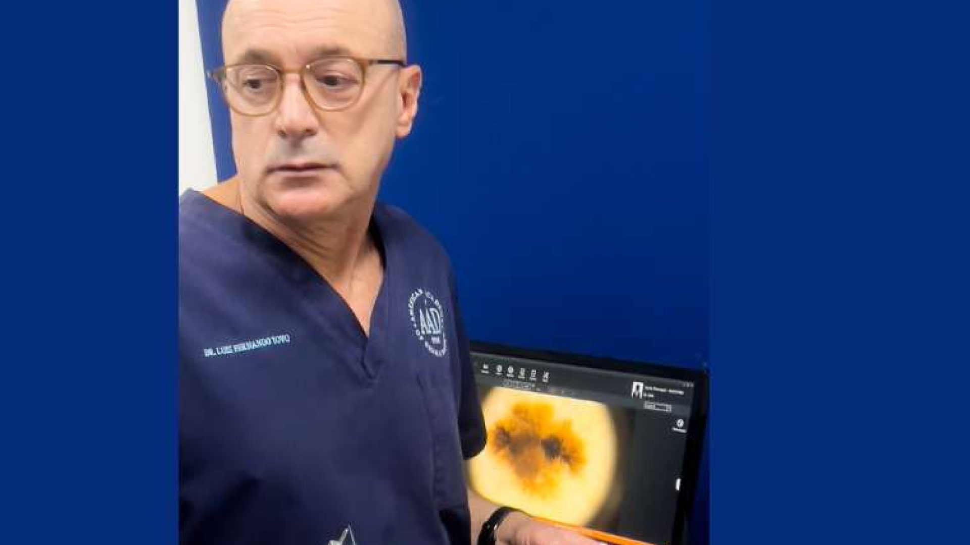 clinica-tovo-luis-fernando-tovo-dr-tovo-explica-o-que-e-a-dermatoscopia-digital/