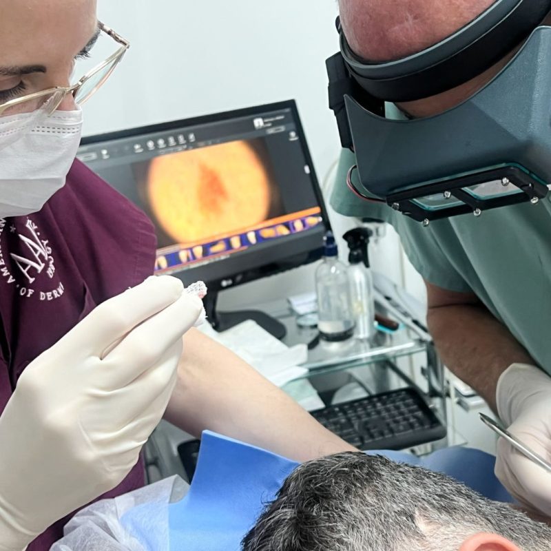especialista em melanoma em sao paulo