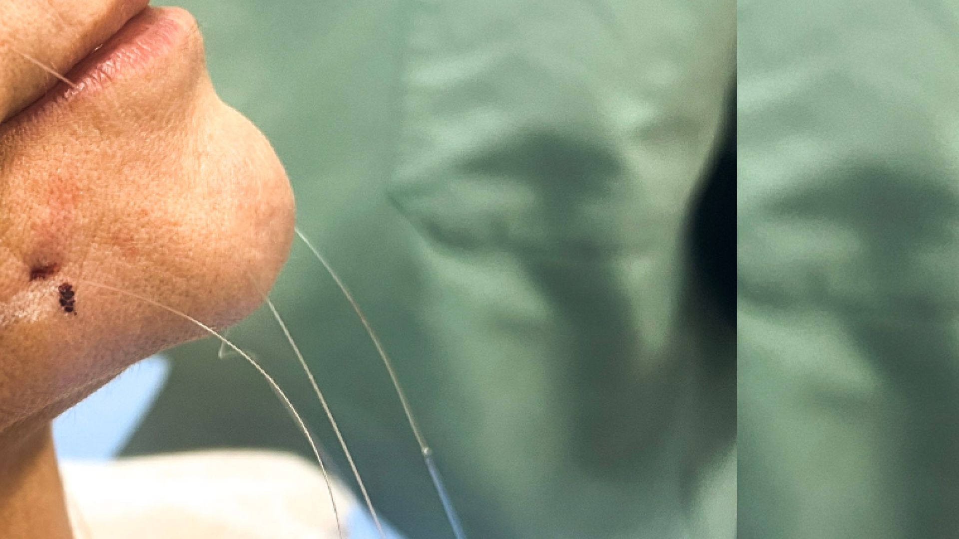 fiosdesustentaçãosilhouettedrtovo