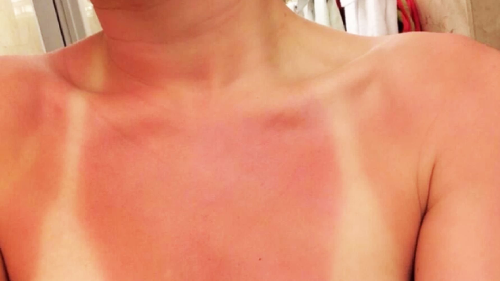 protetor solar uso ou não uso? clinica tovo