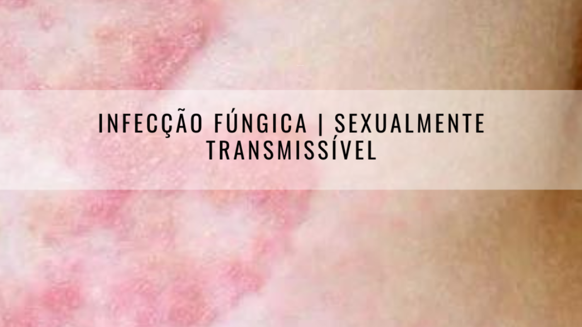 infecção fungica dr tovo