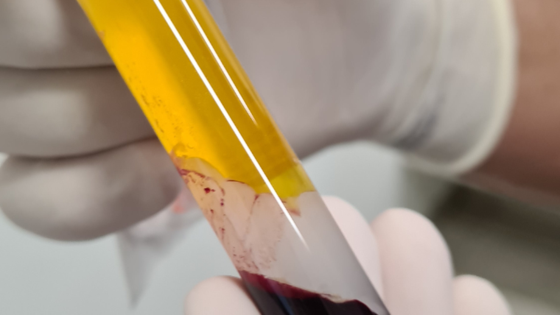 usodegorduracutâneanadermatologiadrtovo