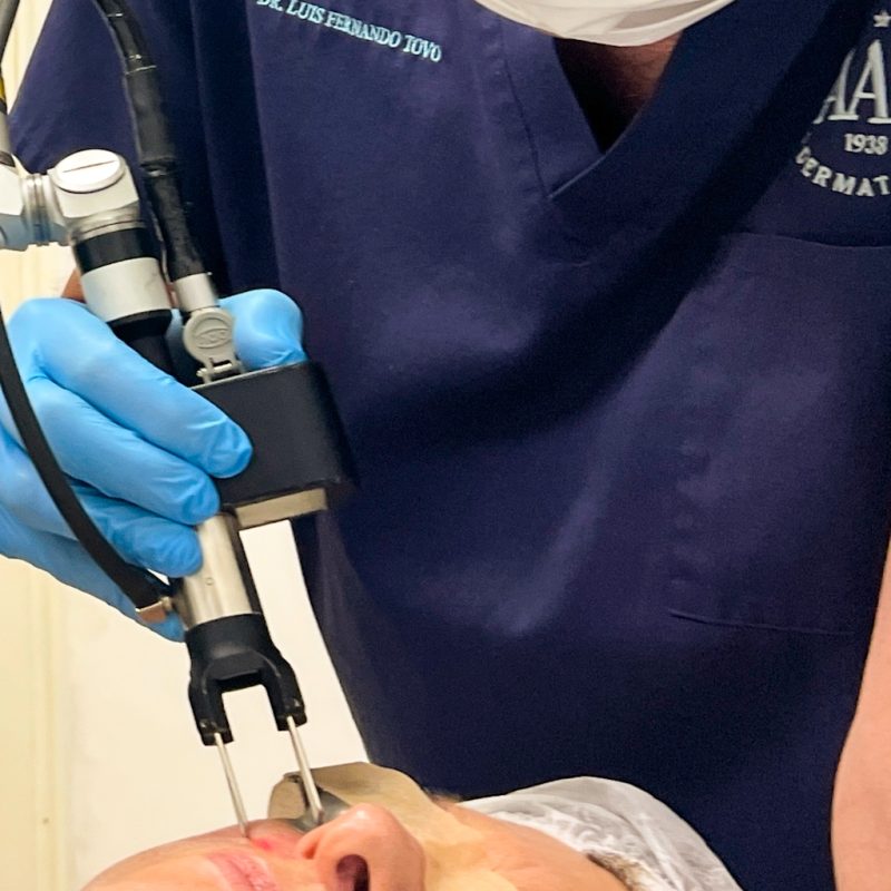 procedimentos estéticos laser clinica tovo
