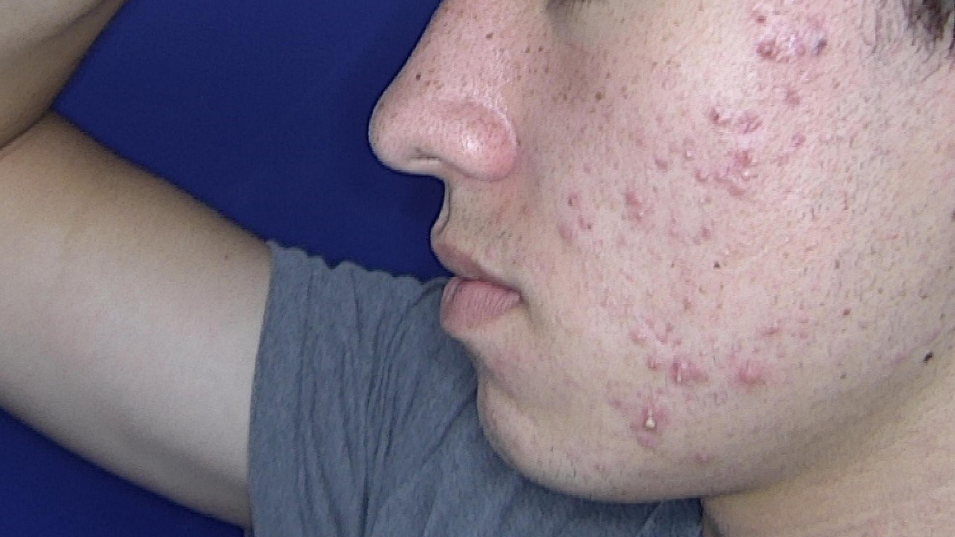 roacutanadolescentedrtovo